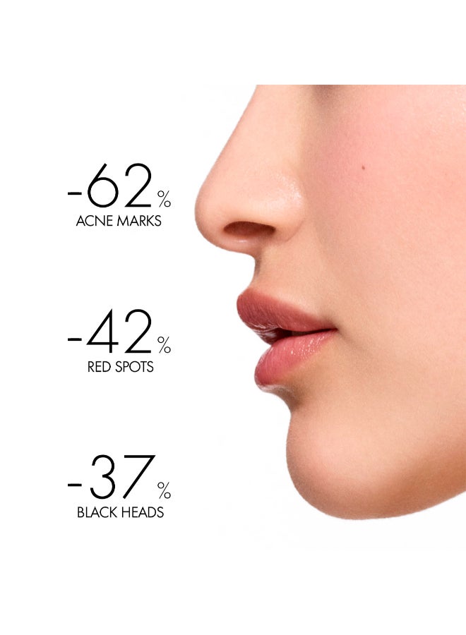 Normaderm Acne Prone Skin 50ml - image 3