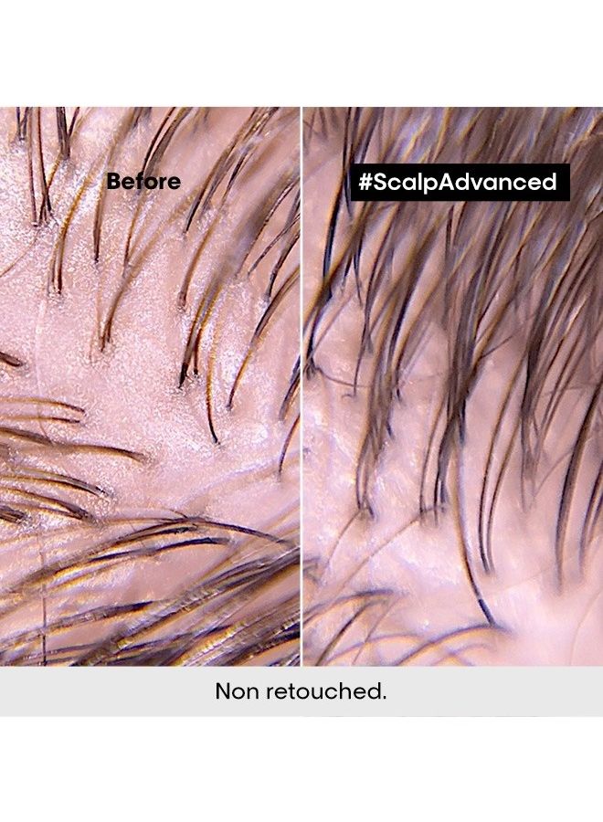 Scalp Advanced Anti-Oiliness 2-In-1 Deep Purifier Clay 250ml - image 6