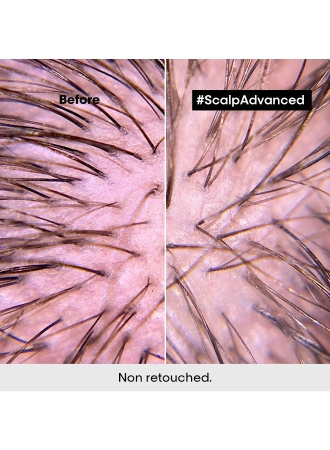 Scalp Advanced Anti-Discomfort Intense Soother Treatment 200ml - image 5