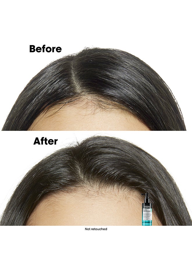 Scalp Advanced Anti-Oiliness 5 in 1Hair serum - 90ml - image 6
