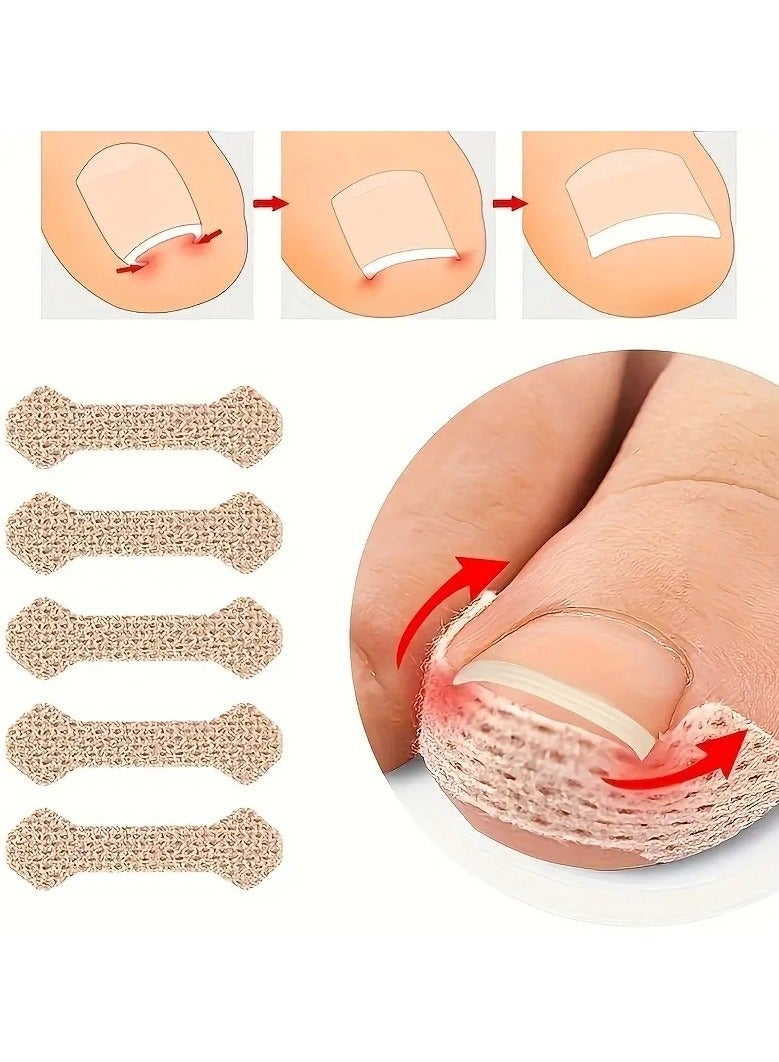 100pcs Toe Nail Corrector Patch Elastic Patch Sticker Corrector Pedicure Tools Fingernail Toe Nail Care Protects Toe Nail