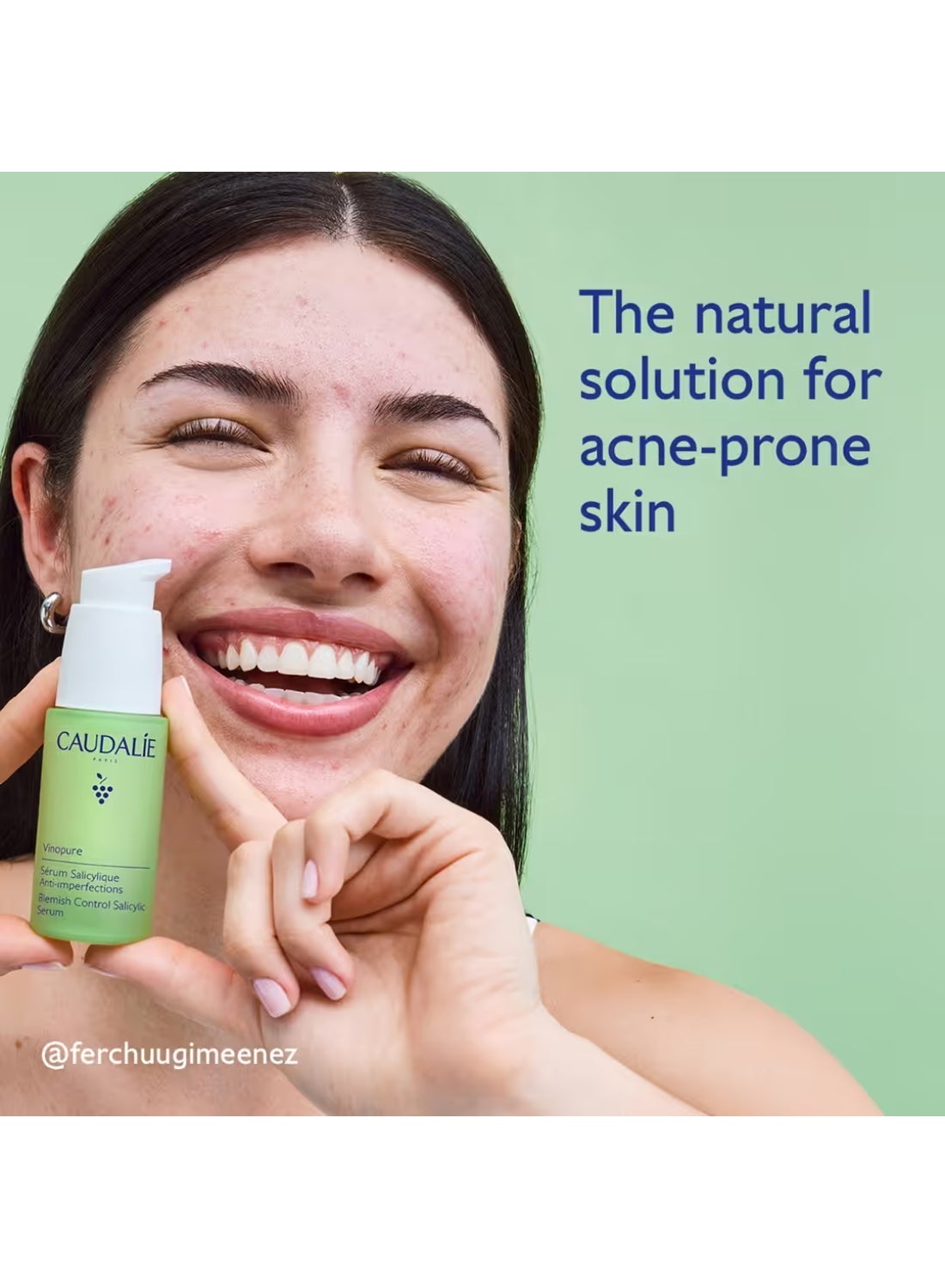 Vinopure Blemish Control Salicylic Serum - 30 mL - image 2