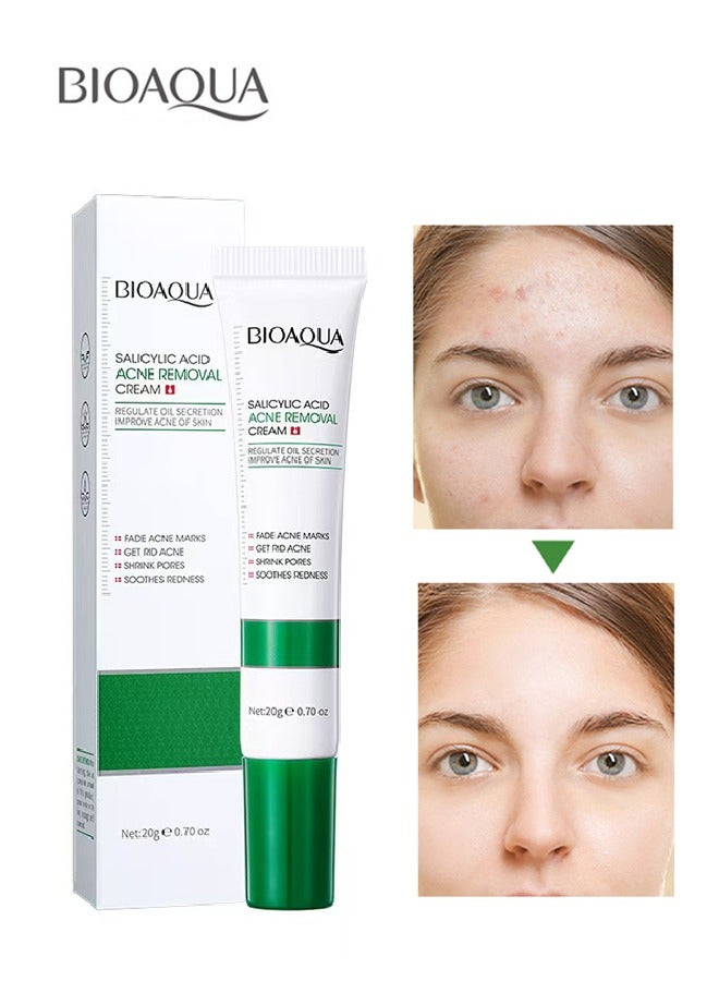 Salicylic Acid Acne Removal Cream , Acne Treatment Face Cream, Acne Spot Treatment for Face & Acne Dots, Natural Cystic Acne Treatment, For All Skin Types, Premium Acne Scar Cream & Pimple Remover 20g