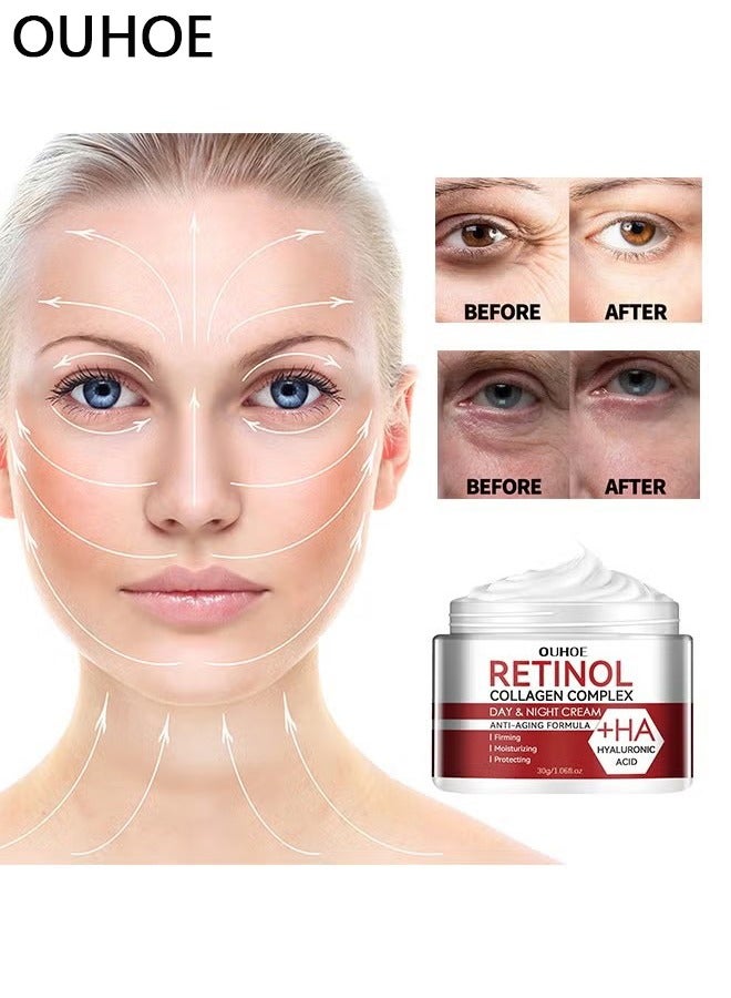 Retinol Collagen Complex 30g, Anti Aging Cream With Hyaluronic Acid And Collagen, Wrinkle Removal Skin Firming Cream, Retinol Moisturizer Cream For Skin Tightening, Dry Lines And Fine Lines