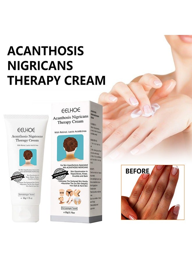 Acanthosis Nigricans Therapy Cream- with Lactic Acid ,Dermatologist Tested Retinol Cream , Hyperpigmentation Removal Cream , For Dark Body Parts like Neck Ankles Knuckles Armpits 50g