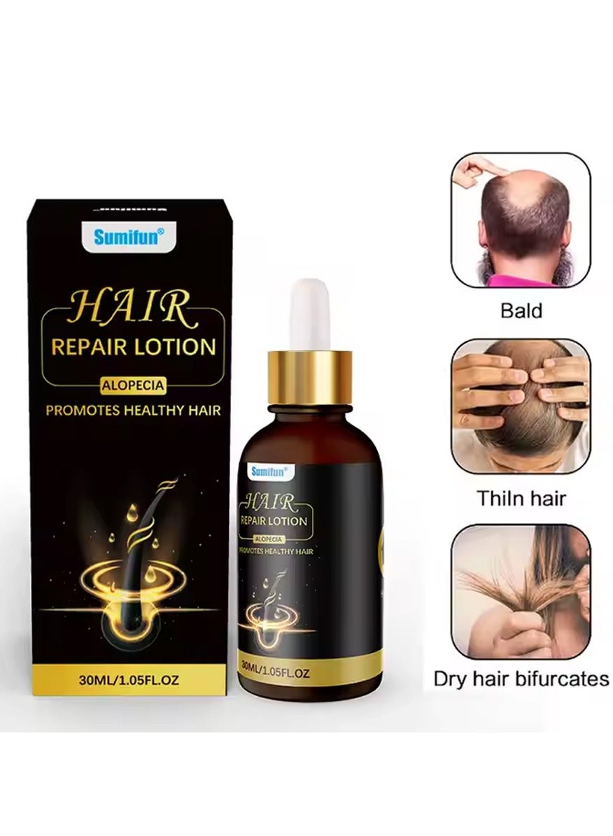 Hair Repair Lotion, Hair Oil, Hair Loss Treatment, Moisturizing Anti Loss Hair Growth Essence, Promote Healthy Hair, Strengthen Hair Growth 30ml