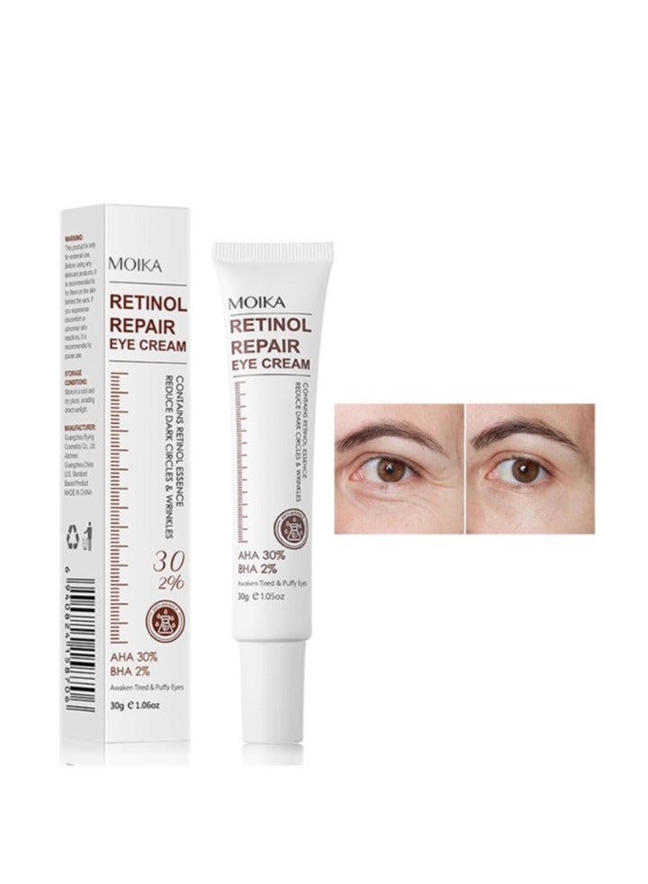 Magic Retinol Eye Cream for Puffiness and Bags Under Eyes, Instant Results Firm Eye Tightener Anti Aging Under Eye Cream for Men Women, Reduce Fine Lines Wrinkles and Age Spots 30g