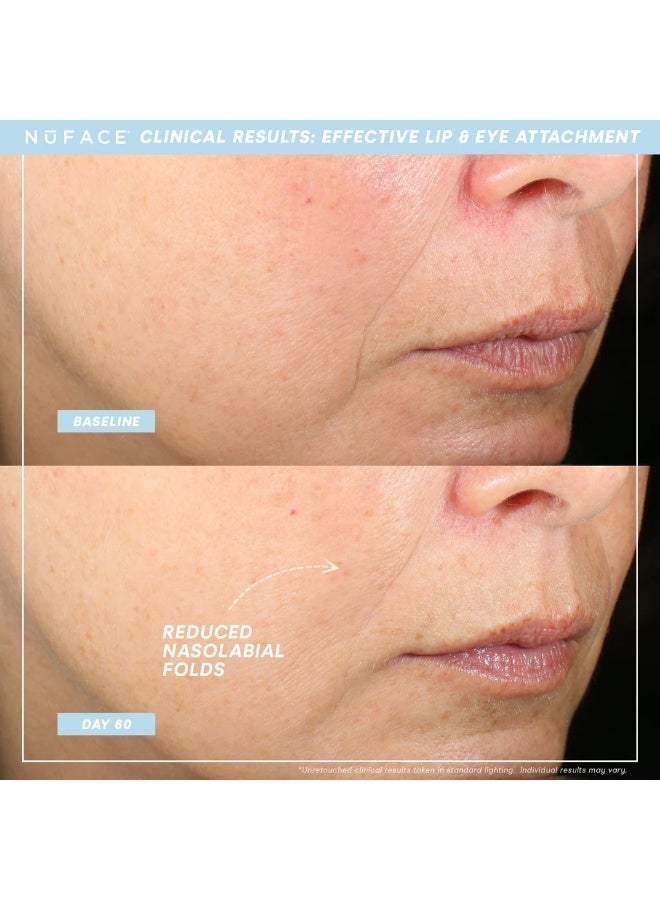 Trinity+ Lip And Eye Enhancer Attachment (NEW) - image 2