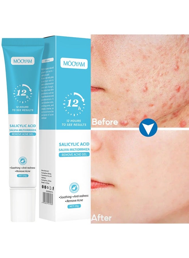 Salicylic Acid Remove Acne Gel, Rapid Action Acne Spot Treatment for Face Closure & Acne Dots, Premium Acne Scar Gel & Pimple Remover  20g