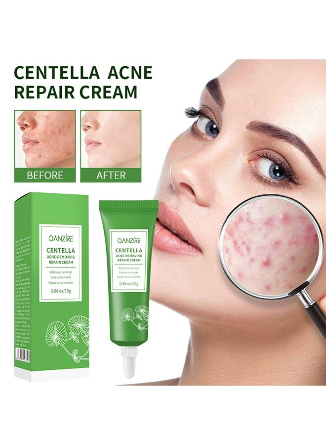 Acne-Removing Repair Cream, Acne Removal Acne Pimple Repair Cream, Natural Cystic Acne Treatment, Premium Acne Scar Cream And Pimple Remover (15g)