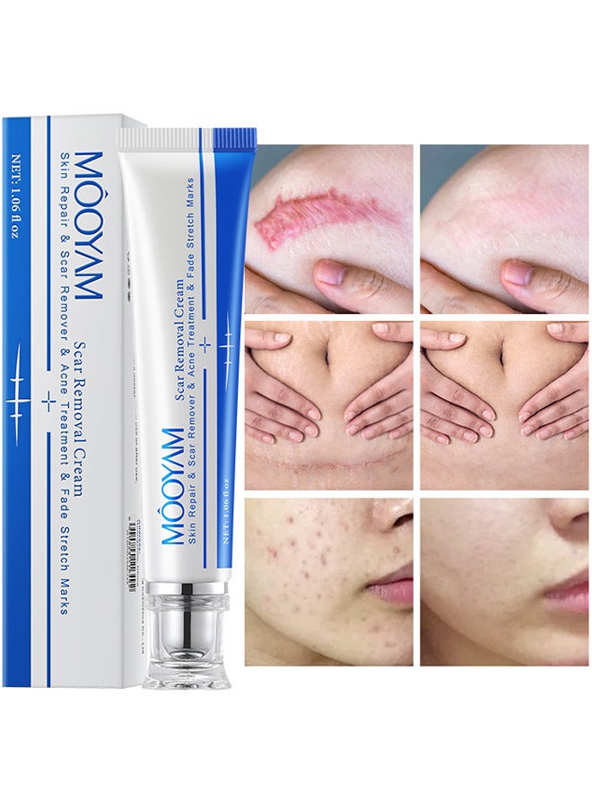 Scar Removal Cream, Skin Repairing Cream Fade Scars And Stretch MarksAnd Acne Treatment, Improve Scar Skin, Deeply Moisturizes Skin, For Surgical Scars Stretch Marks Acne Old Or New Scars