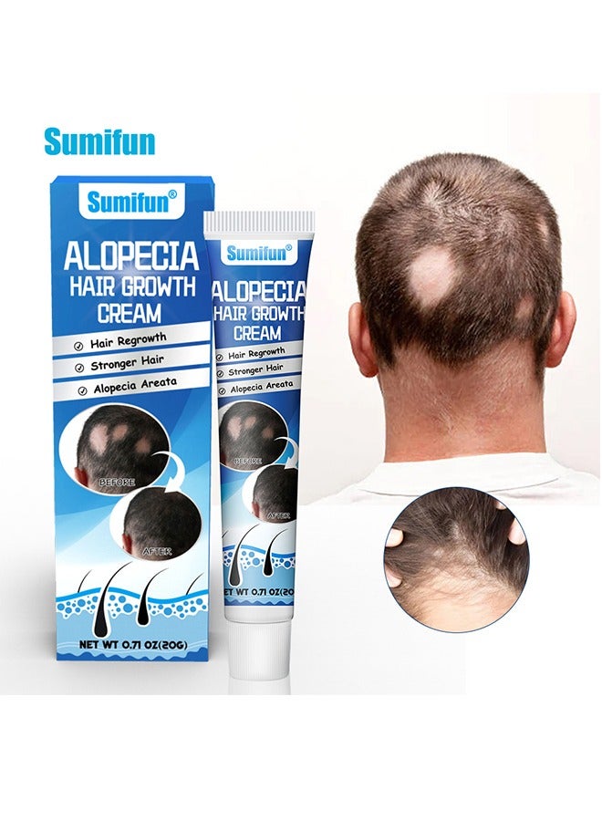 Alopecia Hair Growth Cream - for Promote Men's Hair Growth,Prevent Hair Loss,Care for Hair 20g