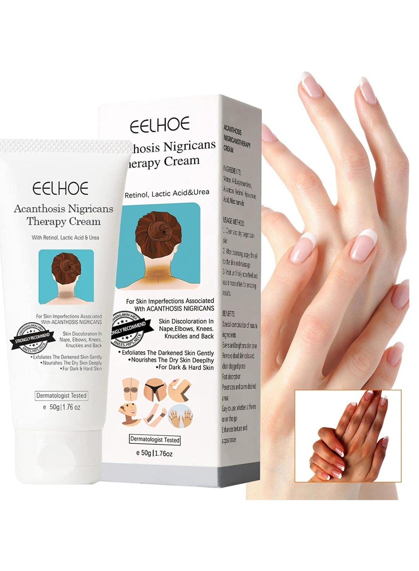 Acanthosis Nigricans Therapy Cream - Reduces Dark Elbows - Acanthosis Nigricans Therapy Oil - Acanthosis Nigricans Treatment (1 pc)