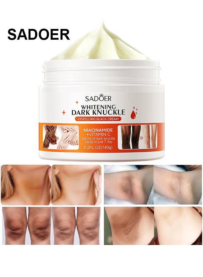 Dark Knuckle Whitening Cream, Skin Body For Dark Knees And Elbows, Moisturizing Joint Whitening Cream With Niacinamide Vitamin C, Lighten And Repair Melanin, Dark Spot Corrector Remover