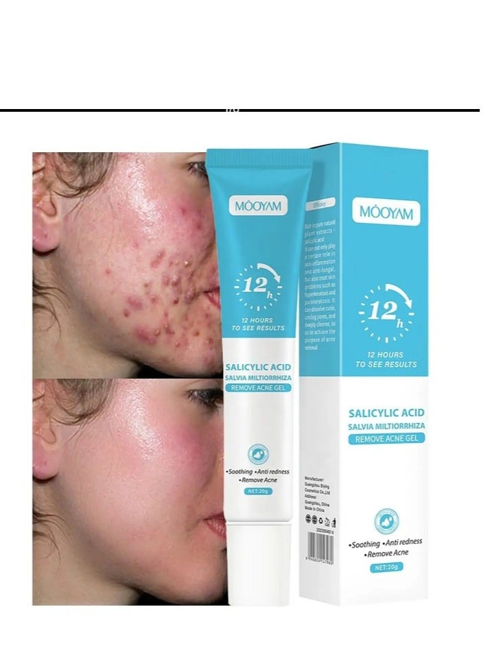 Acne Treatment Gel,Anti Acne Removal Cream,Spot Cream for Acne,Spot Treatment for Face,Face Care Acne Cream,Acne Gel,Acne Scar Treatment,Daily Skin Care,Acne Moisturiser,Acne Scars Recovery 1Pcs