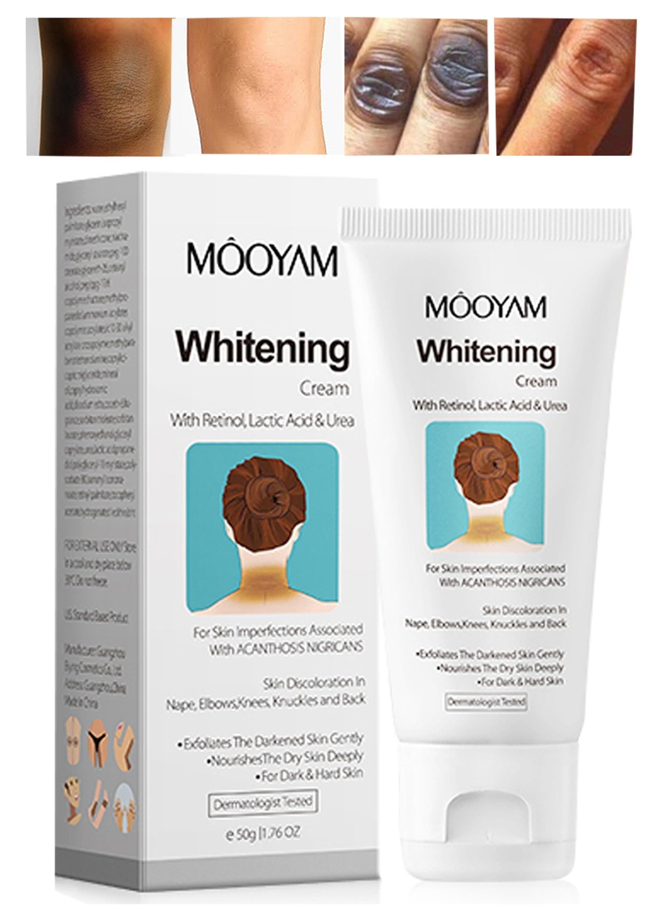 Whitening Cream, with Retinol, Lactic Acid and Urea, for Darkened Skin on Body Exfoliates Dark Spots, for Dark and Hard Skin
