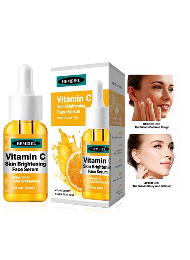 Vitamin C Skin Brightening Face Serum, Hyaluronic Acid & Vitamin E - Natural Organic Anti-Wrinkle & Skin Rejuvenating Moisturizer Vitamin C For All Skin - Anti-Aging Serum (30ml)