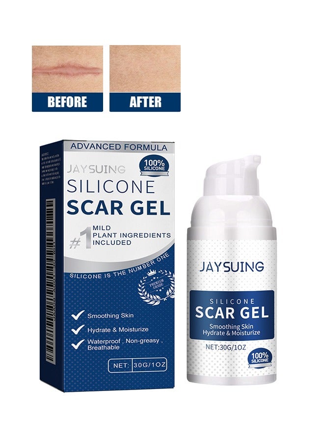Silicone Scar Gel 30g ,Scar Removal,Scar Treatment, Scar Removal Cream for C-Section, Stretch Marks, Acne, Surgery, Effective for Both Old and New Scars
