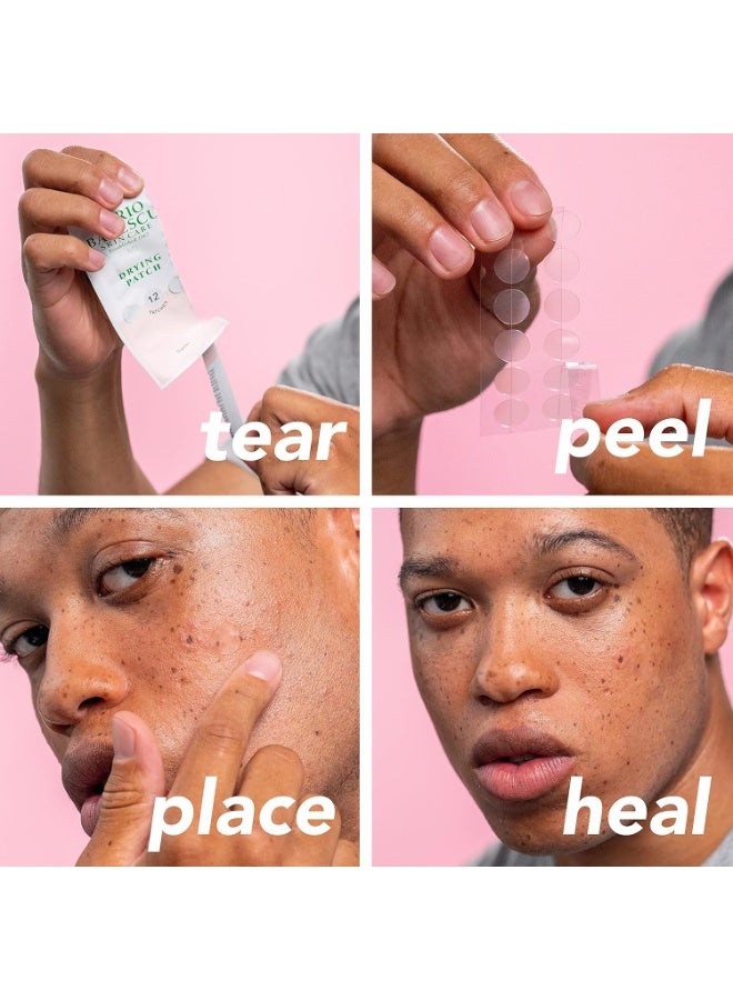 Drying Patch 60 Patches | Hydrocolloid Acne Pimple Patches for Overnight Blemish & Spot Treatment | Absorbs Excess Oil & Speeds Up Healing for Whiteheads & Active Breakouts | Invisible Skin-Safe Acne Stickers - image 6