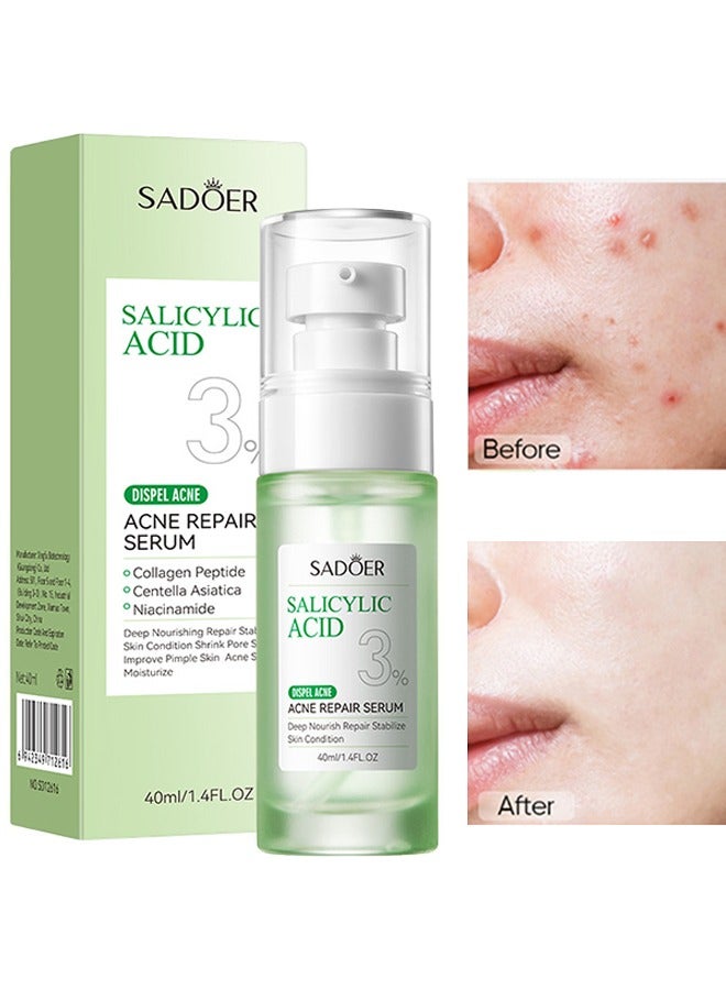 Salicylic Acid Acne Repair Serum-Salicylic Acid Oil Control Acne Treatment Essence, Anti-Acne Exfoliating Gentle Salicylic Acid Serum, Promote the Renewal of Epidermal Cells, Delicate Skin 40ML