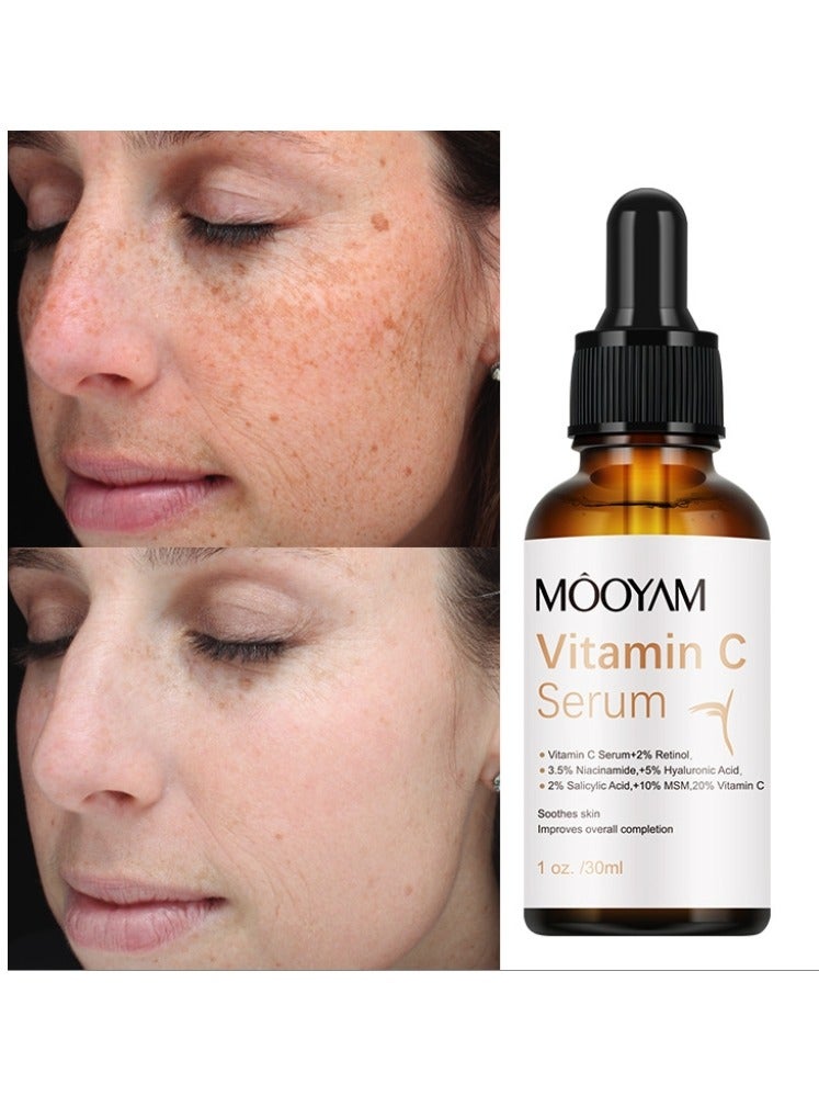 Vitamin C Serum, Soothes Skin, Improves Overall Completion Moisturizing Firming Pearl Skin Antioxidant All Skin For Women And Men Face