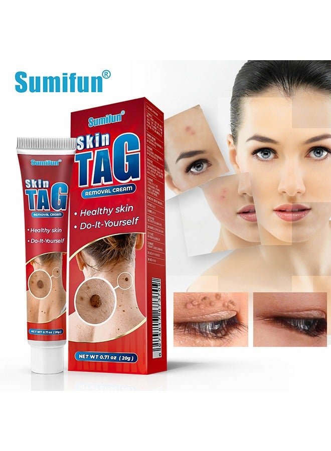 Skin Tag Removal Cream,Remove Warts,Remove Moles and Smooth Skin, Skin Tag for Common Treatment Effective and Safe 20g