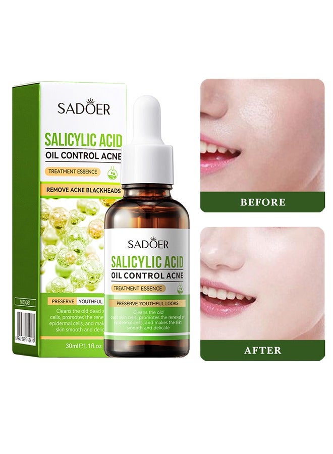 Salicylic Acid Oil Control Acne Treatment Essence, Anti-Acne Exfoliating Gentle Salicylic Acid Serum, Facial Serum, Promote the Renewal of Epidermal Cells, Delicate Skin 30ml