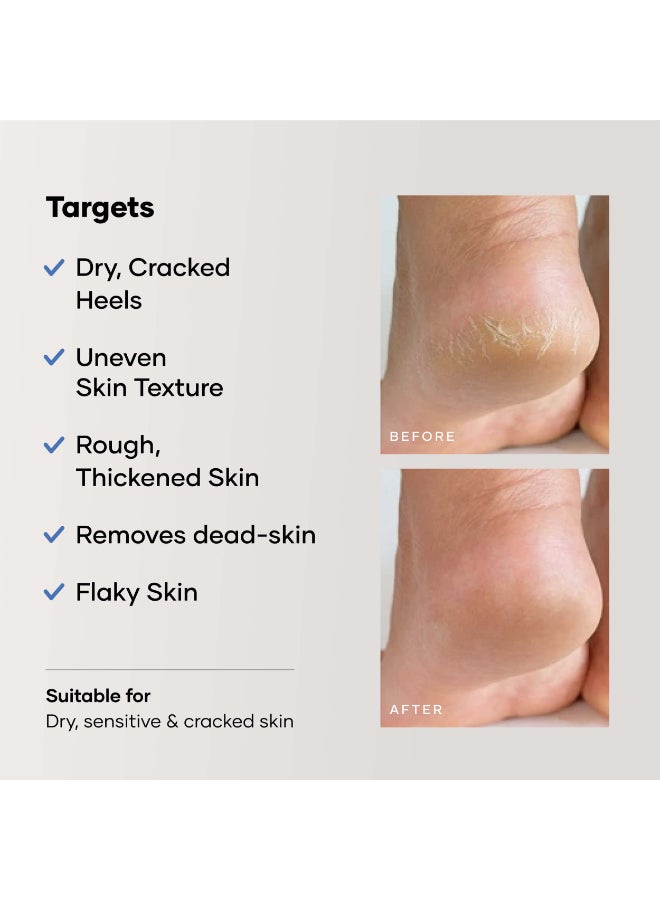 Cureskin Foot Care Cream for Cracked Heels | Repairs, Softens, and Exfoliates | Foot Cream for Women and Men, 50 g (Pack of 1) - image 5