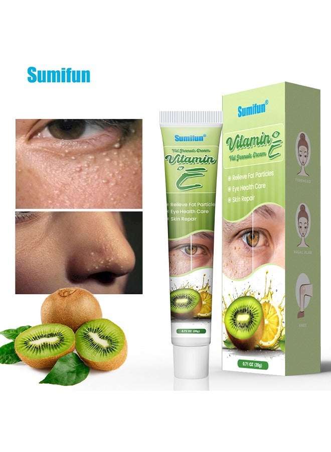 Vitamin E Fat Granule Cream - Natural Soft Eye Fat Removal Cream, Anti-Wrinkle Moisturizing Eye Cream, Eye Health Care, Relieve Fat Particles 20g