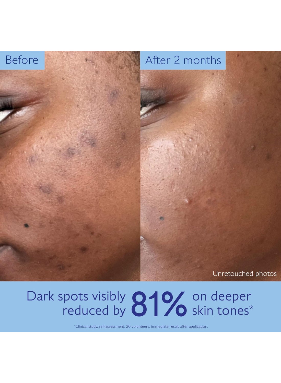 Vinoperfect Brightening Dark Spot Serum - 30 mL - image 4