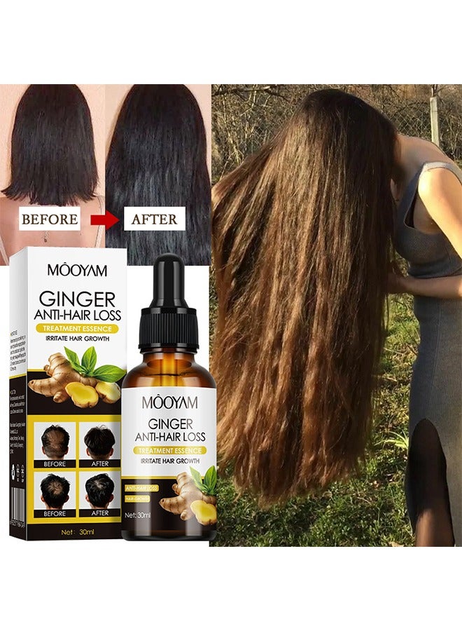 Ginger Anti-Hair Loss Treatment Essence,Hair essence-Plant Ginger Hair Growth Serum Ginger Nutrition Hair Care For Women & Men 30ml