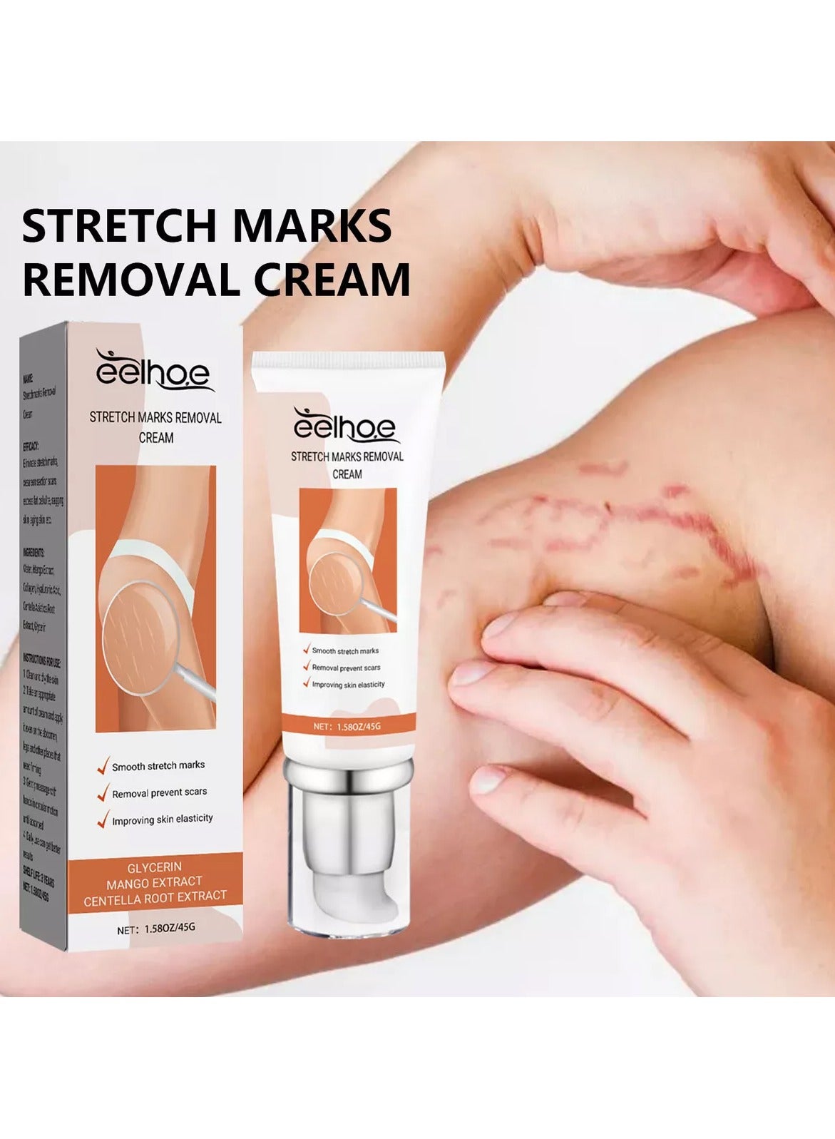 Dermease Stretchmarks Removal Cream, Stretch Mark Removal Cream, Stretch Mark Scar Cream, Scar Cream Gel, Scar Care Cream, Help with Stretch Marks, Surgery, Injury, and Burns Scars