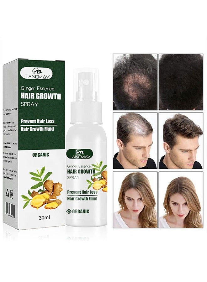 Ginger Essence Hair Growth Spray, Ginger Herb Formula Stop Hair Loss Hair Regrowth Treatments Grow Thicker Longer Hair Accelerate Hair Growth for Men and Women 30ml