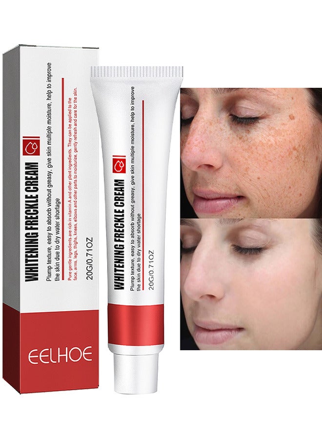 Whitening Freckle Cream, Help Reduce Dark Spots, Anti-Aging, Beauty Skin Care, Spot Cream, Spot Treatment 20G
