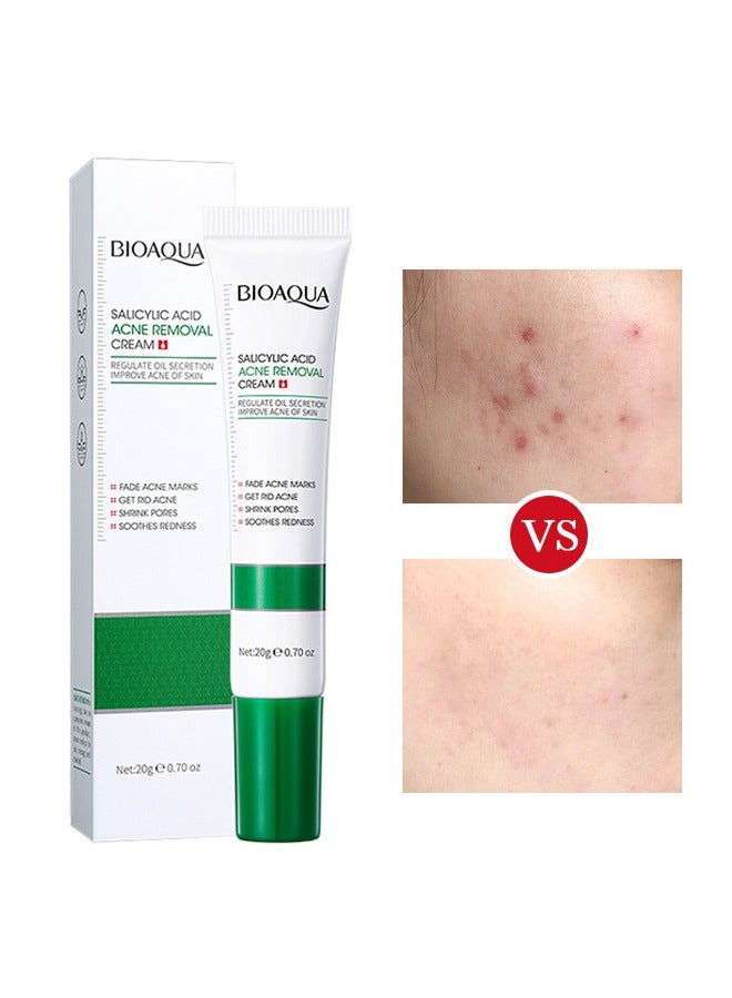 Salicylic Acid Acne Removal Cream , Acne Treatment Face Cream, Acne Spot Treatment for Face & Acne Dots, Natural Cystic Acne Treatment, For All Skin Types, Premium Acne Scar Cream & Pimple Remover 20g