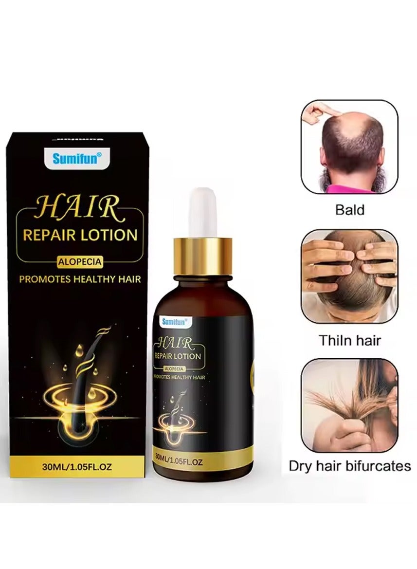 Hair Repair Lotion Alopecia Promotes Healthy Hair，Suitable for both men and women 30ml