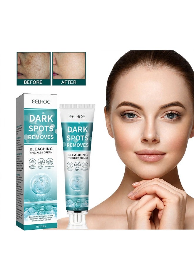Dark Spot Removes Bleaching Freckles Cream For Face, Fast-Acting Dark Spot Corrector Remover For Face And Body Hyperpigmentation, Fades Melasma, Freckle, Sun Spots, Evens Skin Tone, Age Spot Remover