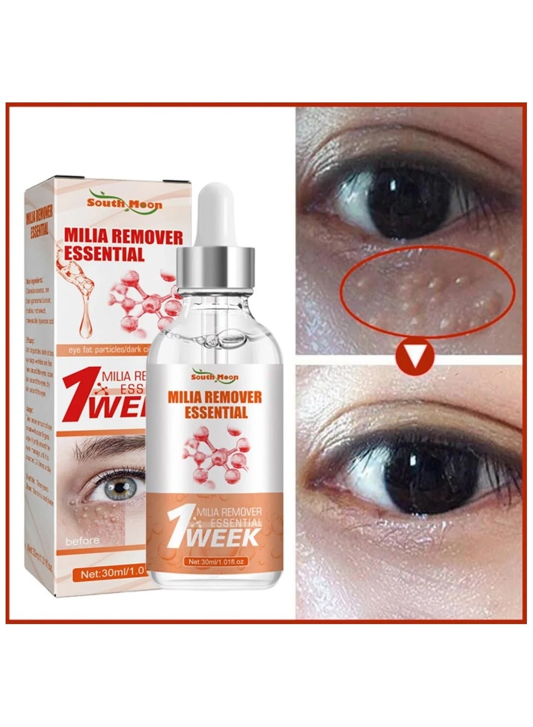 Milia Remover Essential Eye Serum Effective Removes Fat Granules Eye Bags Anti-particles Puffiness