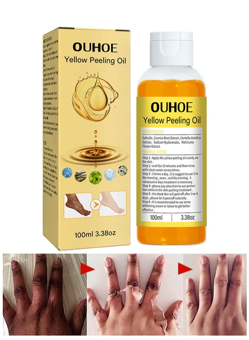 Peeling Oil for Dark Skin, Peeling Solution with Salicylic Acid, Dark Spot Corrector for Body, Skin Brightening Peeling Solution for Dull Skin and Uneven Skin Tone for Glowing and Fresh Skin, 100ML