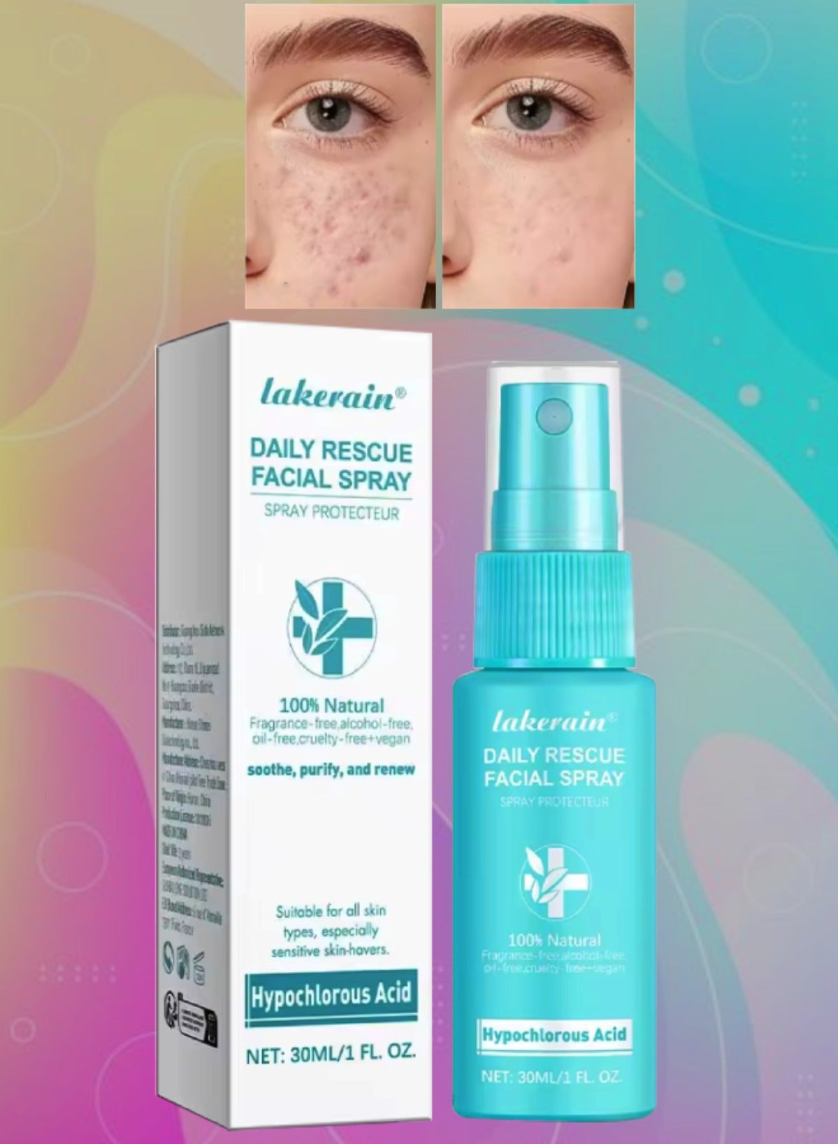 Daily Rescue Facial Spray Facial Spray for Sensitive Skin Facial Rescue Spray with Hypochlorous Acid Helps Reduce Redness and Breakouts Purify renew and Soothing pH Balancing Face Toner 30ml