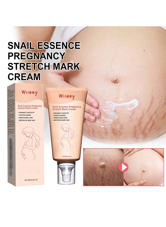 Snail Essence Pregnancy Stretch Mark Cream, Stretch Marks And Scar Removal Cream For Pregnancy, Stretch Marks Scar Belly Creams For Wrinkles, Obesity Fat Stretch Mark Moisturizing, Remove Marks-60ml