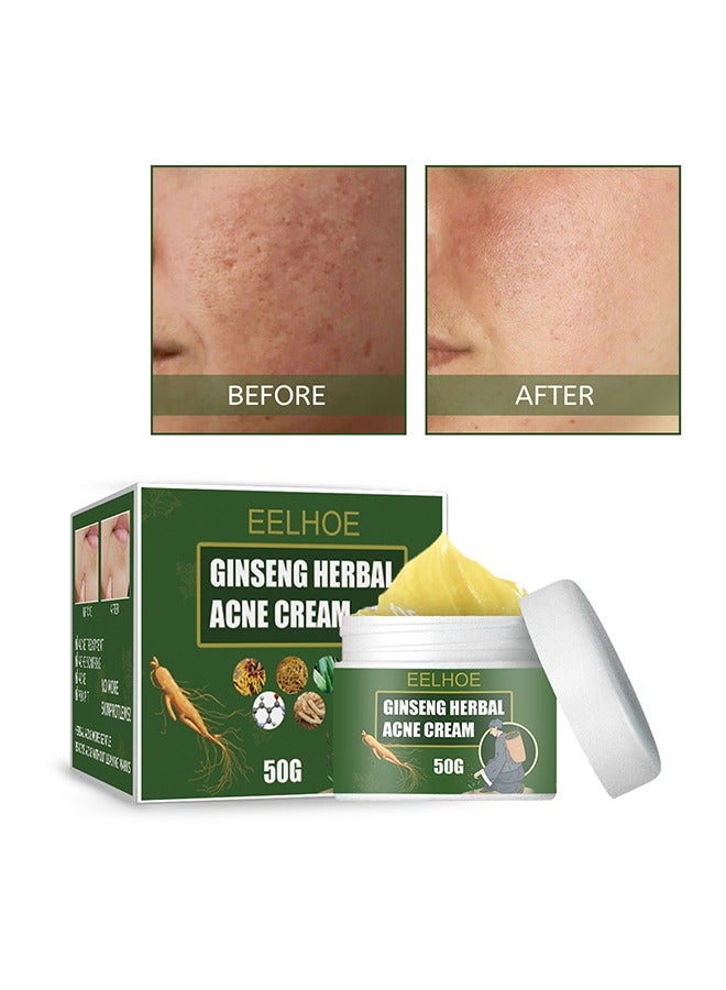 Ginseng Herbal Acne Cream - Herbal Acne Treatment Cream Pimple Spot Removal Control Acne Scar Cream Shrink Pores Skin Care Beauty Health
