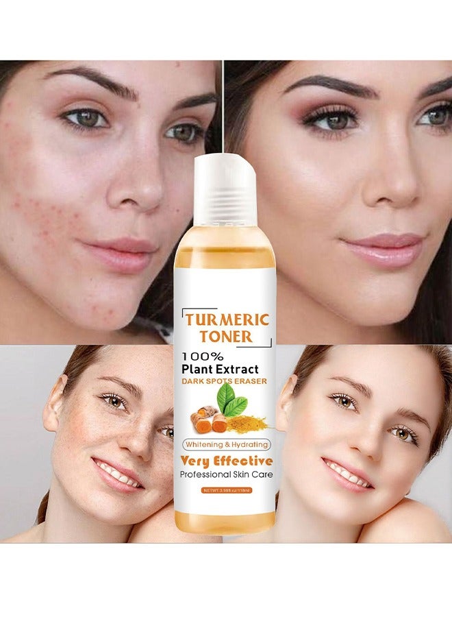 Turmeric Toner 100% Plant Extract Dark Spots Eraser, Corrector Toner 118ML Facial Toner For Acne Prone Skin Dark Spot Remover For Face Hydrating Face Toner For Women Treatment