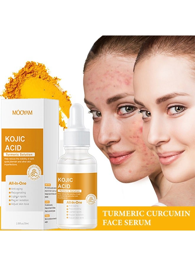KOJIC ACID Turmeric Solution, All Natural Turmeric Skin Brightening Serum - Cleanses Skin, Fights Acne, Evens Tone, Heals Scars