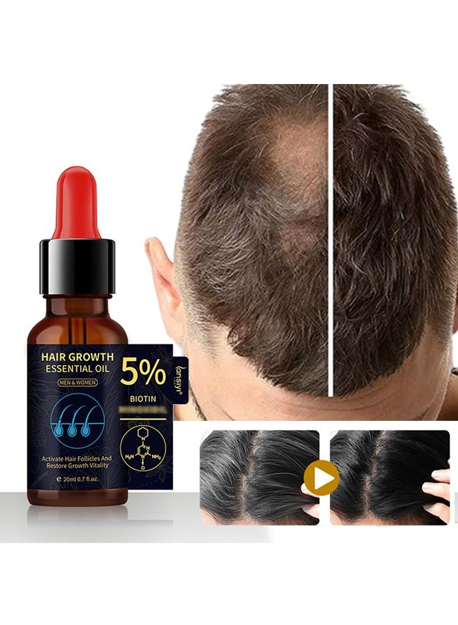 Hair Growth Essential Oil ，5% Minoxidil and Biotin with Natural Herbal Extract for Women Men Hair Regrowth Hair Loss Hair Thinning Treatment 20ml