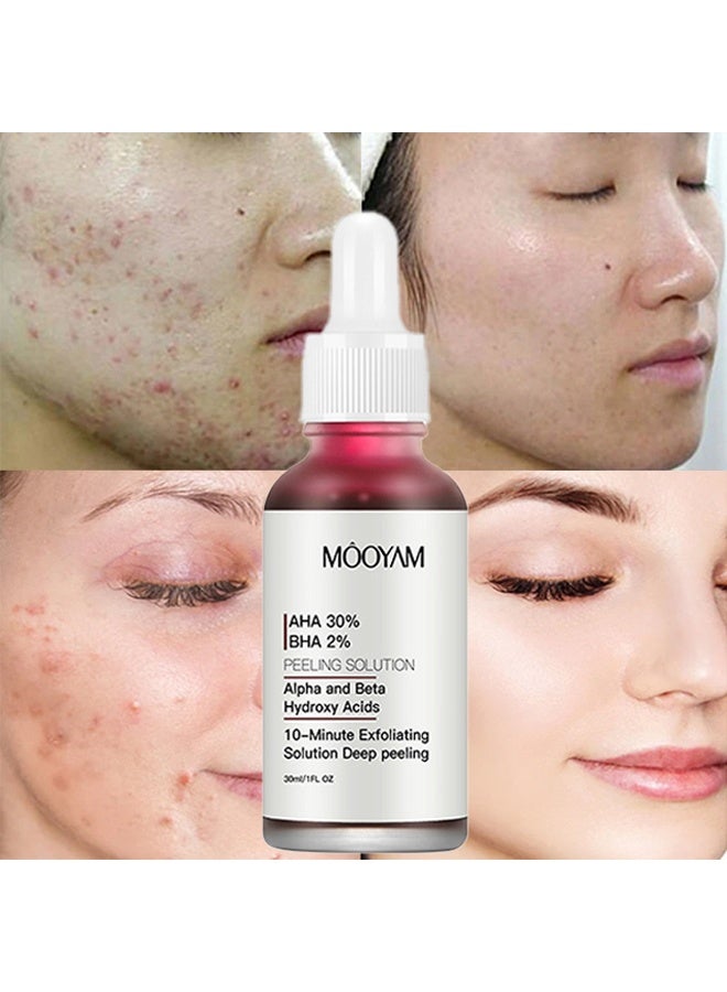 AHA 30% BHA 2% Peeling Solution - AHA 30% + BHA 2% Peeling Solution Exfoliating Anti Acne Serum Chemical Peel for Face at Home BHA AHA Mask Red Peel BHA Liquid Exfoliant for Blemishes Wrinkle 30ml