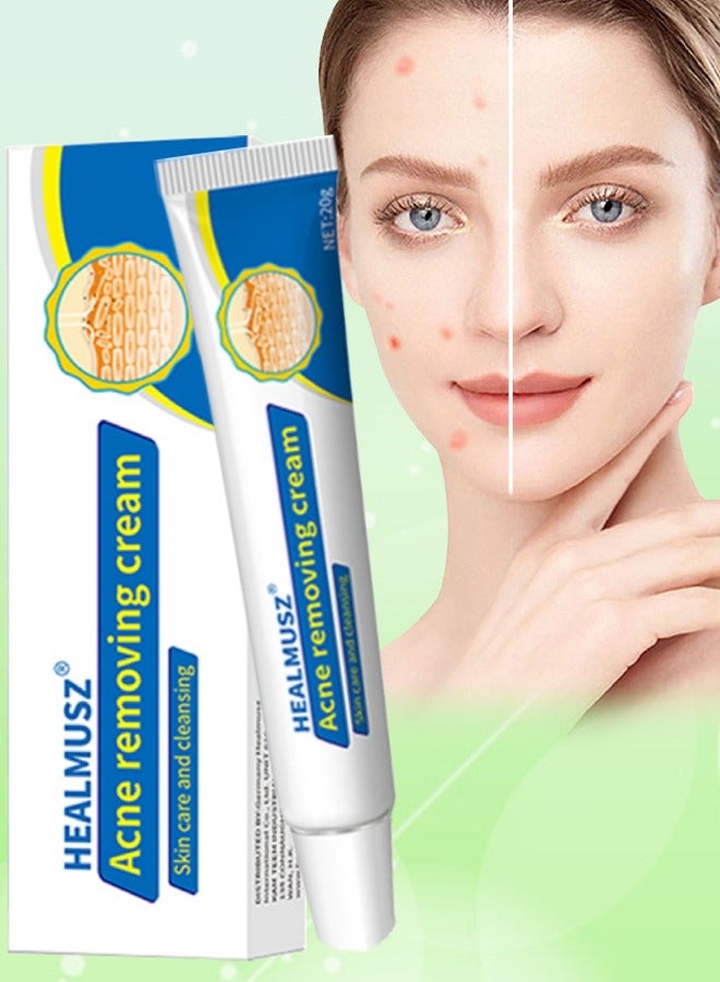 Acne Removing Cream Natural Moisturizing Cream Acne Treatment Cream Skin Care and Cleansing Clear Face and Body Acne Blemish Cream for Acne and Blackheads Pimple Treatment Cream 20g