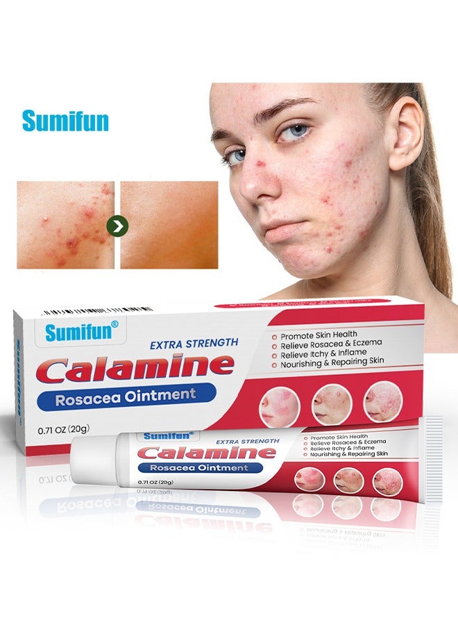 Calamine Rosacea Ointment, Nourishing Repairing Extra Strength Healing Ointment, Effective Relieve Rosacea and Eczema, Fastly Relieve Itchy and Inflame, Promote Skin Health 20g