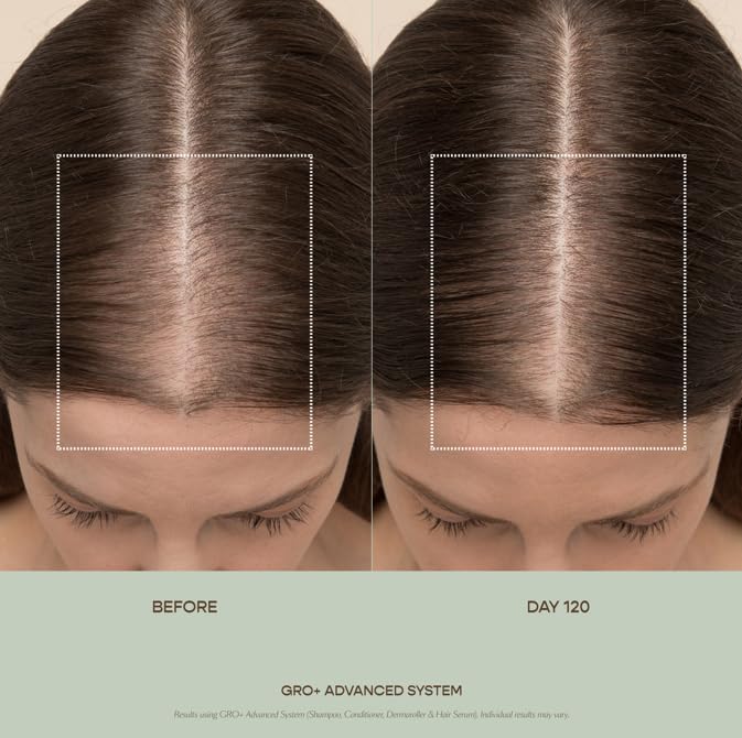 VEGAMOUR GRO+ Advanced Hair Serum for Improving Hair Density, Reduces Shedding and Promotes a Healthy Scalp, 1 pack