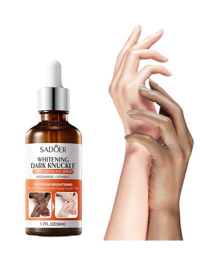 Dark Knuckle Whitening Serum-Whitening Dark Knuckle Dispelling Black Serum with Niacinamide + Vitamin C, Skin Brightening Cream, Dark Spot Remover Cream for Feet & Elbow & Neck & Hands, Get Rid of Dark Knuckle Easily in 7 Days